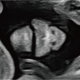 胎児ドックの様子_中期_顔面